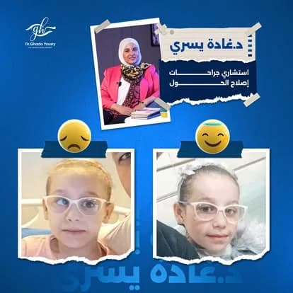نتائج حقيقية قبل وبعد العلاج