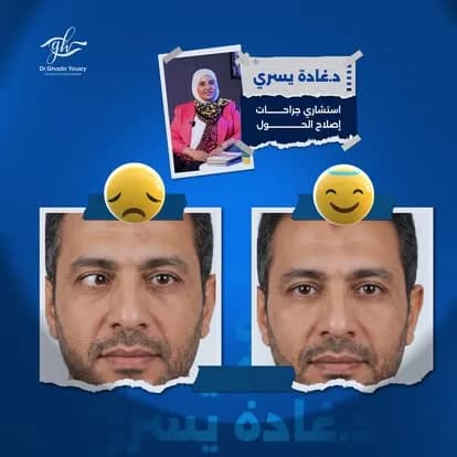 نتائج حقيقية قبل وبعد العلاج