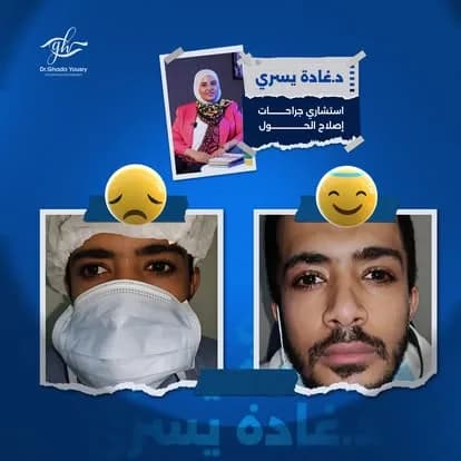 نتائج حقيقية قبل وبعد العلاج